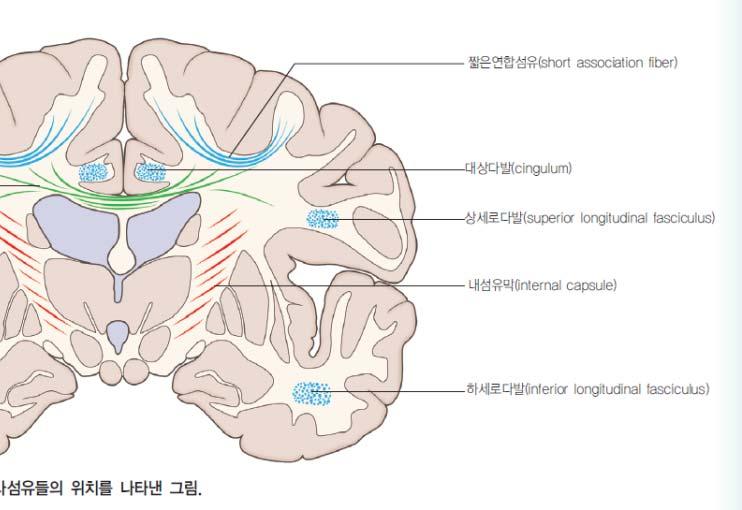 Long association fiber( 긴연합섬유 ) 3. Uncinate fasciculus( 갈고리다발 ) frontal lobe 의앞및아래부분 temporal lobe 행동조절에중요 4.