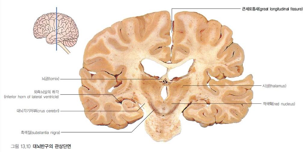 * * Great cerebral fissure( 큰세로틈새 ) = longitudinal cerebral