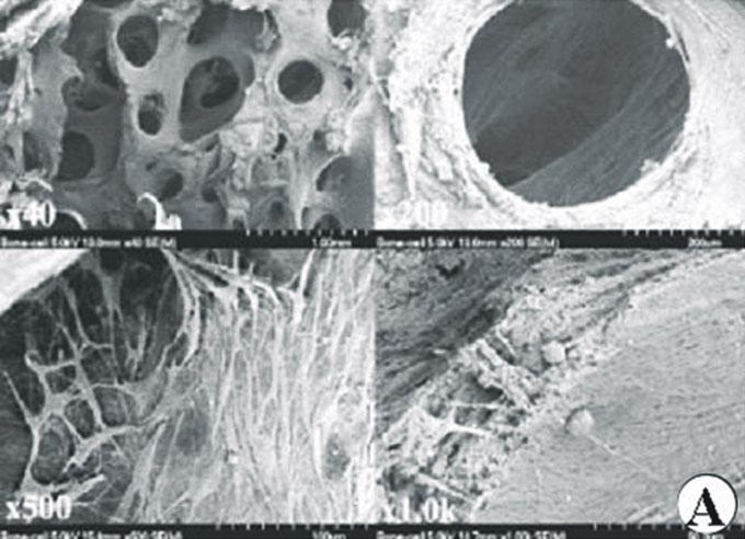 1041 다양한 기질에서 골수 중간엽 줄기세포의 3차원 배양 및 생체이식에 의한 골형성능 A B D C E Fig. 2.