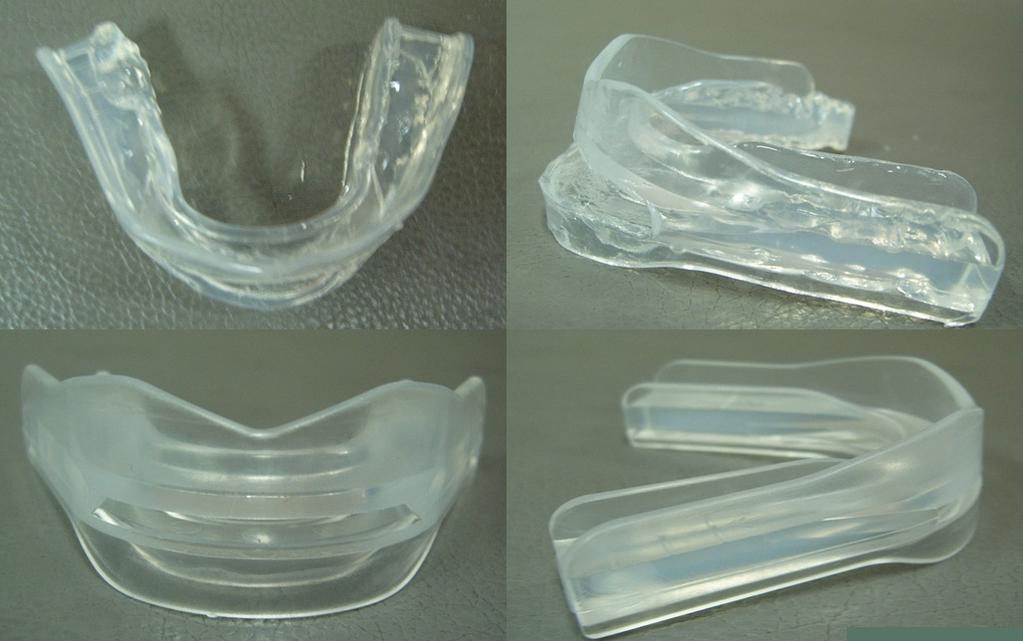김수경김대영김영남이지현조재욱주은연김영호홍승봉 Figure 1. A temporary mandibular advancement device. This monobloc appliance consists of a hypoallergenic thermoplastic body.