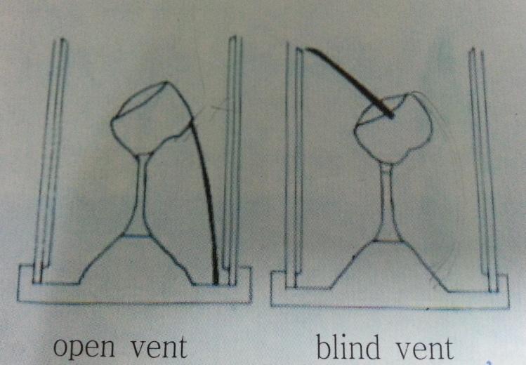 Air vent : 매몰재의통기성을증가시킬목적 - Blind