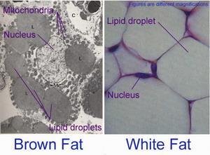 갈색지방세포 vs 백색지방세포