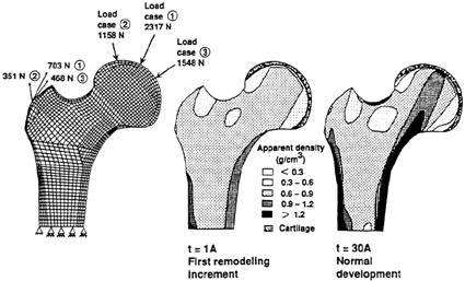 Fig. 5. (Left) Finire element mesh and three loading conditions used to emulate skeletogenesis and bone remodeling in the normal proximal femur.