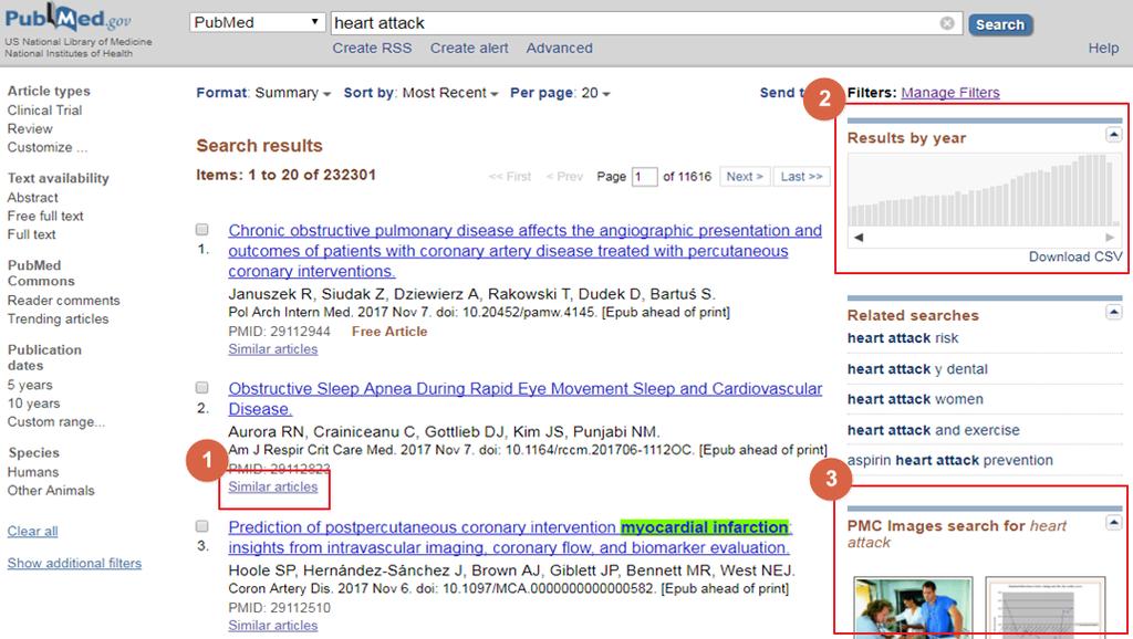 검색결과화면 1. 검색된결과의 Similar article 클릭시관련된다른논문으로재검색한결과보여줌 2.