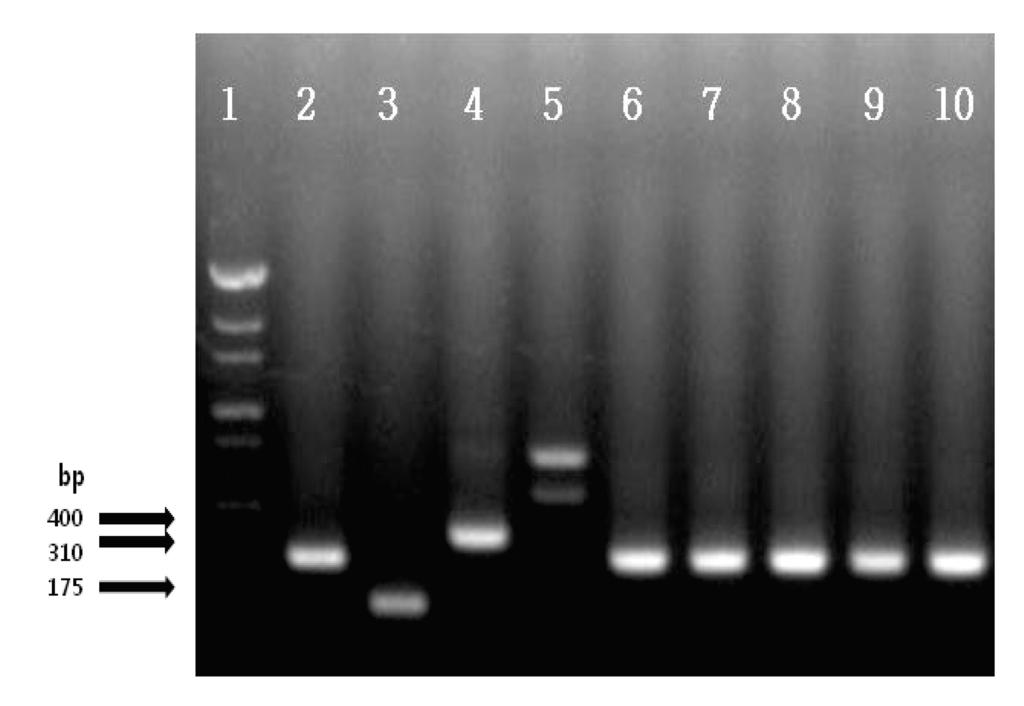 Korean J Clin Lab Sci. Vol. 48, No. 2, June 2016 83 서론 Bacteroides 균속은무산소성그람음성막대균으로서탄수화물을분해하고, 담즙에내성이있으며주로장에서분리된다. Bacteroides 균속에는 20종이상의균종이있고, 이중에서 B. fragilis, B. thetaiotaomicron 및 B.