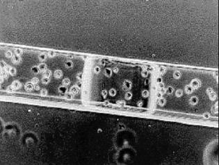 그림 13(a) 는지름이 600 μm인하이드로젤마이크로패턴내부에고정된세포들의광학현미경사진이며, 그림 13(b) 는세포를함유하고있는지름 50 μm 의하이드로젤마이크로패턴을보여주는 SEM 사진이다. PEG 하이드로젤의투명한특성으로하이드로젤내부에고정된세포는광학현미경으로관찰이 가능하다.