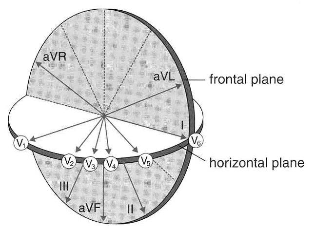 plane AVR AVL (lateral wall ) ( Anteroseptum ) SA RV LV V1 V2 V3