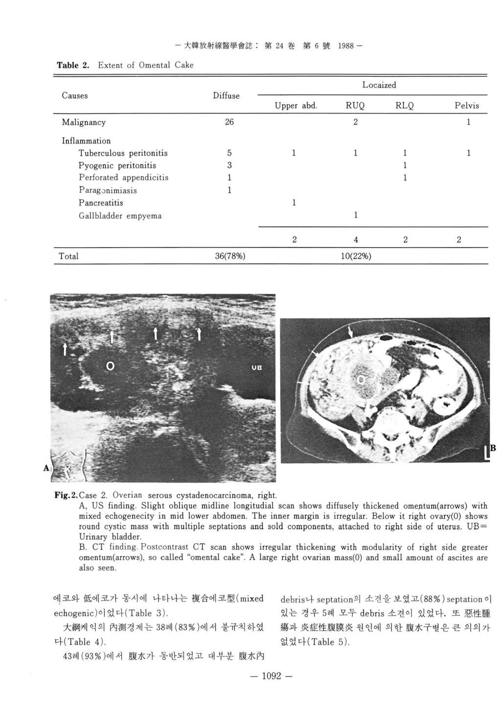 - 大韓放射線뿔學會誌 : 第 4 卷第 6 號 1988 - Table. Extent of Omental Cake Diffuse Locaized Upper abd RUQ RLQ Pelvis Malignancy 6 Tuberculous peritonitis 5 Pyogenic peritonitis Perforated appendicitis Parag.