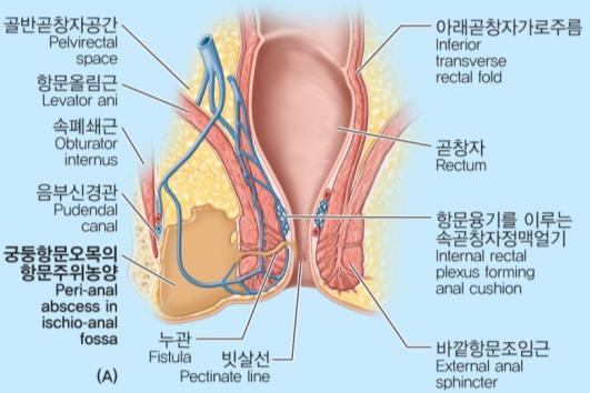 rectal venous plexu의정맥에혈전 (thrombosis) 가생긴경우 임신, 만성변비,