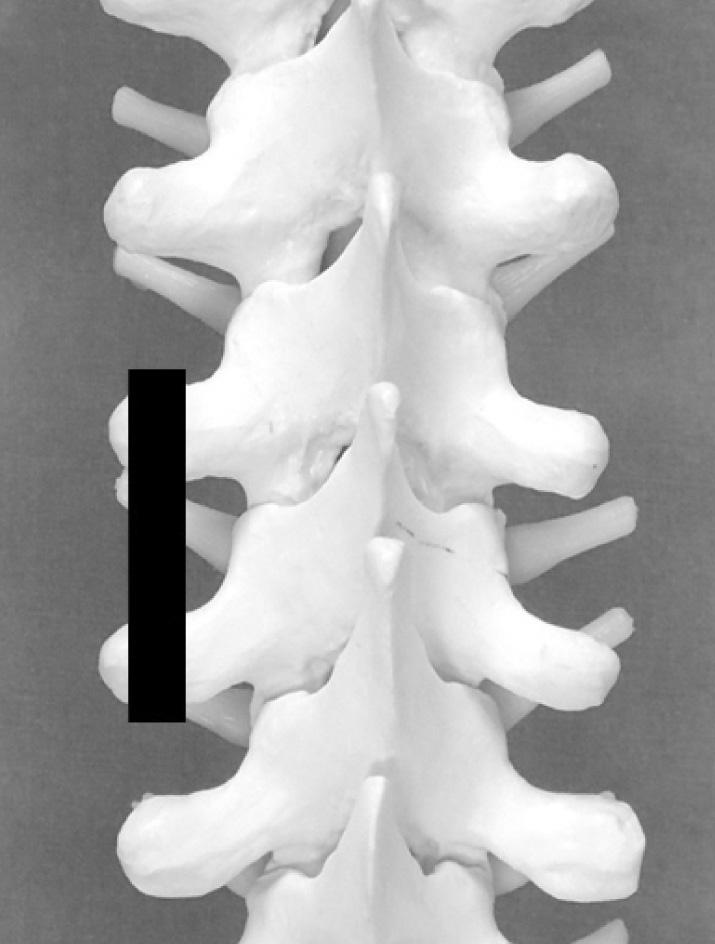 Proximal Distal Figure 3.