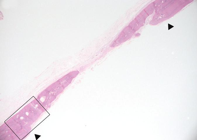 A B Fig. 8. Representative photomicrograph of calvarial defects receiving the bovine collagen matrix at 8 weeks (B; boxed area in A).