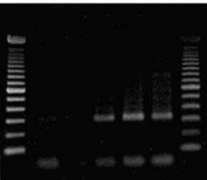 Plasma hnrnp B1 mrna in NSCLC 251 M 1 2 3 4 5 M Plasma hnrnp B1 mrna 4,830 4,430 4,030 Rn vs cycle Rn 3,630 3,230 hnrnp B1 (315 bp) 2,830 2,430 A 2,030 1 5 10 15 20 25 30 35 40 Cycle number B Fig. 1. (A) Amplified bands (315 bp) were identified on agarose gel electrophoresis after plasma hnrnp B1 mrna RT-PCR.