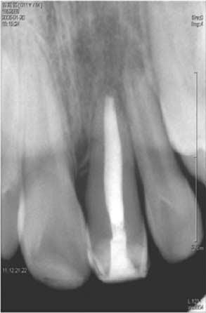 Fig. 8. Radiograph after 24 months. Fig. 9. Photograph after 24 months. 다 (Fig.