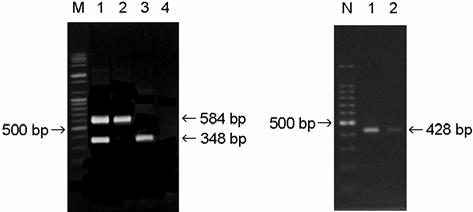 AEEC 의 LEE 관련유전자의병원형 73 Table 4. Serotypes of AEEC used in this study A B Strains Sources No.