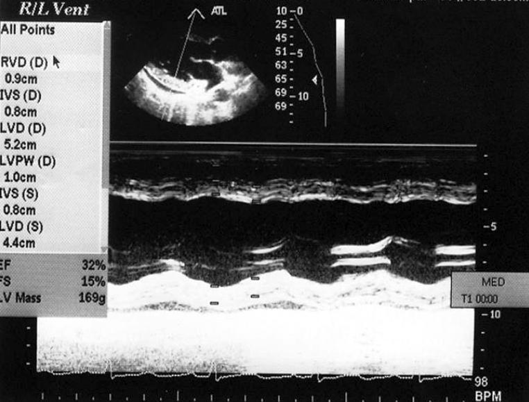 Transthoracic echocardiography (M-mode echocardiography) shows a borderline left