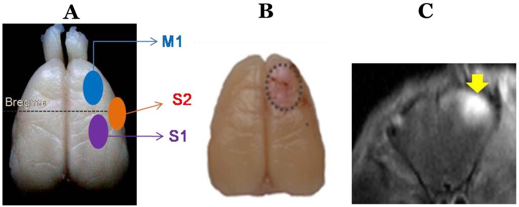 유현광외 3 인. 전정보상과대뇌피질 Figure 1. Cortical areas and photothrombotic ischemic injury. (A) Definition of cortical areas where were injured or electrically stimulated in this study.
