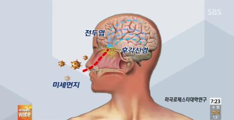 미세먼지와뇌기능퇴화 미세먼지가코를통해뇌로들어가뇌의퇴화를빠르게진행시킨다 (