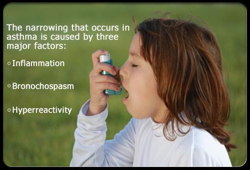 EIA(exercise induced asthma) symptoms can be observed at any moment during or after physical activity.