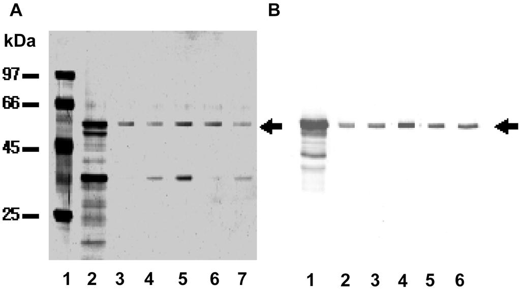 Vol. 4, No. 4 Phospholipase D w ey j m v 97 Fig.. A typical chromatogram of Streptomyces somaliensis phospholipase D on antipld3 IgG-Sepharose. Arrow represent elution start of 0.