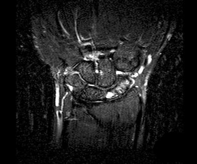 A 33-year-old man who was induced
