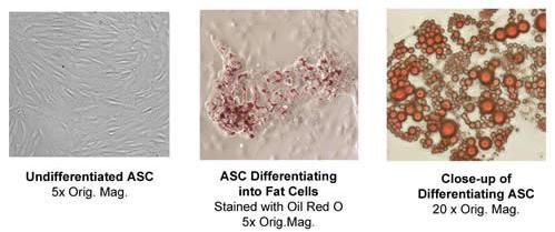 Chondrocytes Cardiomyocytes Differentiation inducing Factor Shaking Centrifuge