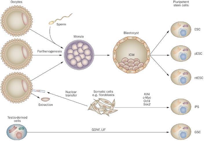 Stem