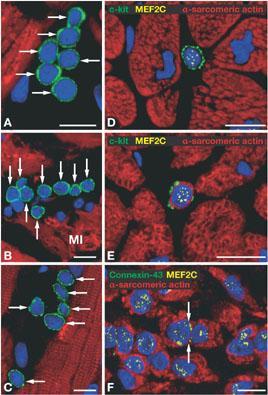 Cardiac Stem Cells Hair