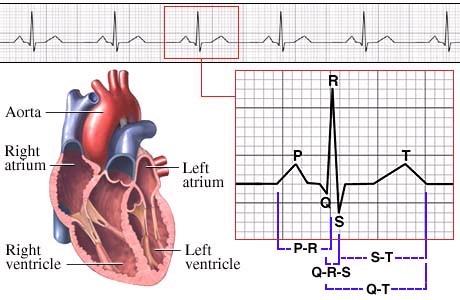 2) 심전도계와심전도 (electrocadiogram-ecg) 심장이활동하는동안의전기적자극을기록한그래프를심전도 (ECG or EKG : Electro-cardiogram) 라고하며일반적으로 12 유도 (lead) 를사용하여기록한다.