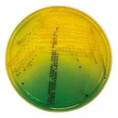 at 36 ± 1 C, aerobic Salmonella spp : 중앙이검거나혹은검지않은붉은색집락