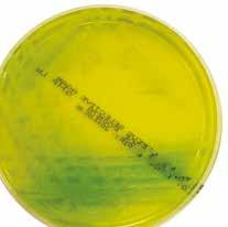 coli: 자주색집락 Cl.