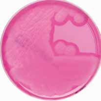 jejuni : 회색집락 PALCAM 한천배지 (CM0877+SR0150) Escherichia coli
