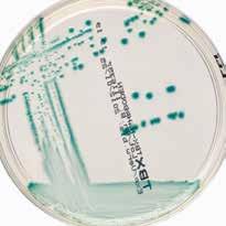 coli O157 : 무색집락기타 E.