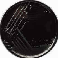 monocytogenes: 검은색으로변함 Bacillus cereus ATCC 10876 8 24 hr.