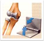 평면관절 (sliding joint) - 관절면이편평하여운동성이비교적적음예 ) 손목이나발에있는뼈사이의관절 4.