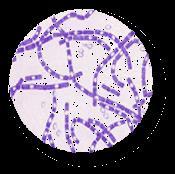 Bacteria 의구분 : 호기성