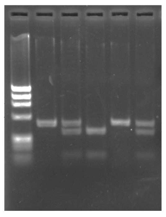 DNA 침전물 (pellet) 을실온에서건조시키고 DNA hydration solution (Gentra Systems) 20 ml으로녹여실험에이용하였다. 2. 골수도말슬라이드에서 DNA 추출 3.