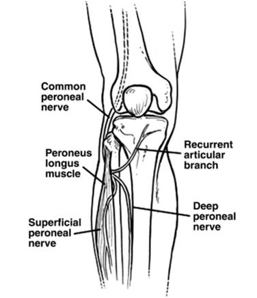 *Entrapment point: posterior tibial nerve가 tarsal tunnel 통과시발생 (posterior tarsal tunnel syndrome) Fig. 4.
