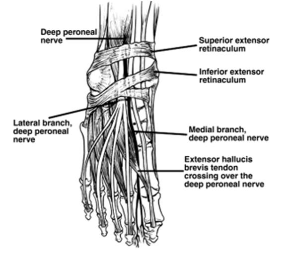 CPN, common peroneal nerve; SHBM, short head of the biceps muscle; LHGM, lateral head of the gastrocnemius muscle.