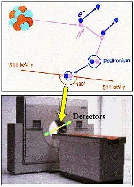 Townsend 가 CTI, Siemens 와함께제작한것이다 (Beyer 등, 2000; Townsend 등, 2000)(Fig. 2).