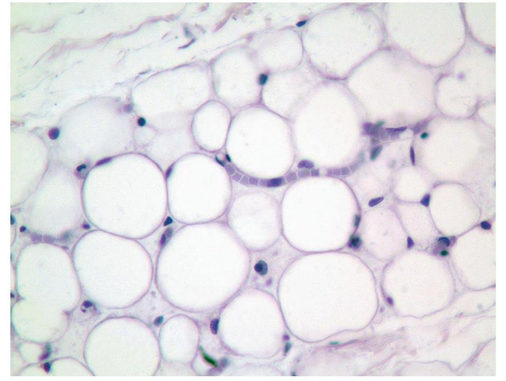 Figure 31-7 Adipose tissue