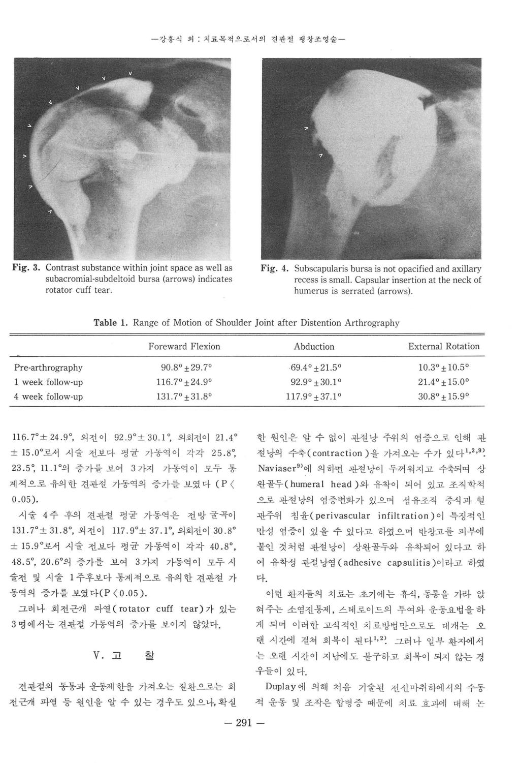 강홍식외 치료목적으로서의견관절팽창조영술 Fig. 3. Contrast substance within joint space as we\l as subacromial-subdeltoid bursa (arrows) indicates rotator cuff tear Fig. 4.