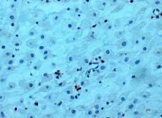 Red arrows indicate positive stained CD16 + NK cells.