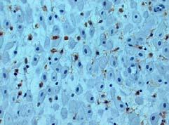 (2) 면역조직화학염색연구에사용한일차항체로는 CD56과 CD16에대한 mouse monoclonal antibody인항체 (novocastra TM, Vision BioSystems Ltd.