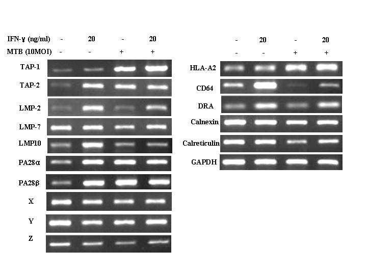 Fig. 18. RT-PCR analysis to exam the mrna expression pattern of genes involved in MHC class I antigen processing in macrophages. Total cellular RNA from human macrophages infected with M.