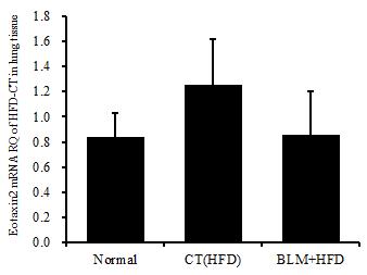 156 A study of the effect on obesity in taeeumin animal-experimental model induced lung fibrosis with Bleomycin (A) Eotaxin2 (B) IL-4 (C) IL-6 (D) IL-5 (E) MUC5AC (F) TARC (G) TNF-α (H) IL-13 The