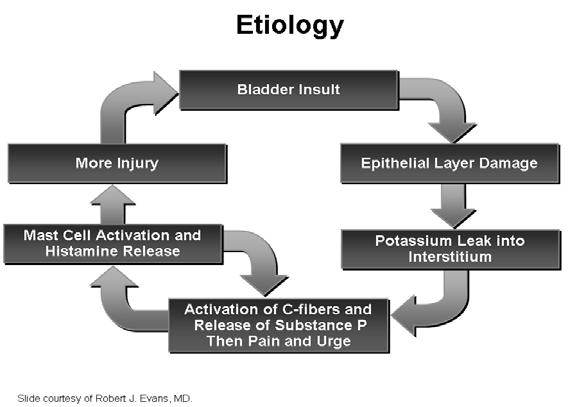 이형래 :Current Management of Bladder Pain Syndrome (BPS) / Interstitial Cystitis (IC) Pentosanpolysulfate (PPS) Possible mechanisms of benefit in IC Replace