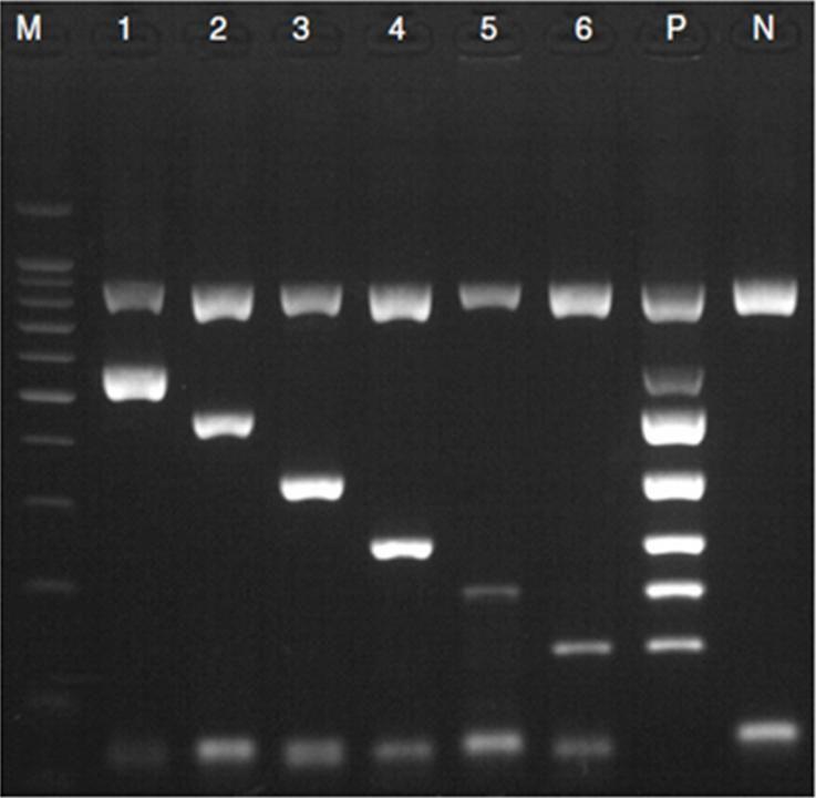 이건송외 1 인 : 천안지역소아백일해감염의유병률과임상적고찰 (Fig. 1). 3) Direct DNA sequencing B. pertussis 에양성인 3명의 PCR 결과물에서 2 염기쌍의밴드부분을잘라 purification 한후 direct DNA sequencing 시행하여 B.