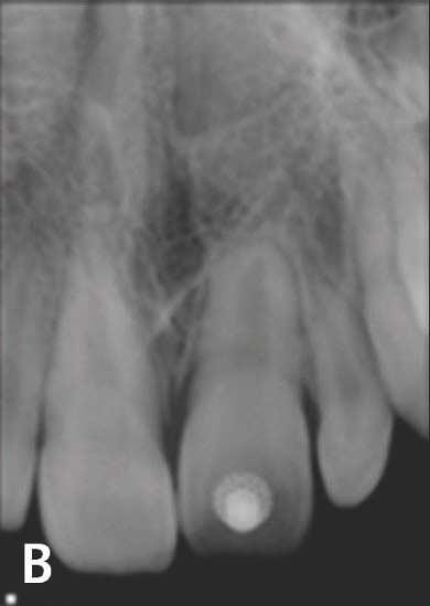 Intraoral photograph(a),