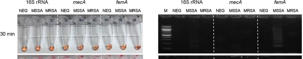 A B Fig. 2. Visual (A) and agarose gel (B) images of the 16S rrna, meca, fema loop-mediated isothermal amplification (LAMP) product of MSSA and MRSA on various reaction times.