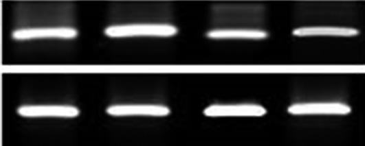 정선효 estosterone Inhibits PPARγ-induced Adipogenesis 대조군세포에비해 PPARγ mrna 발현이 16.8% 증가하였다 (P<.5) (Fig. 2). 그러나테스토스테론이처리된세포는 vehicle 이처리된대조군세포에비해 PPARγ mrna 발현이 15.